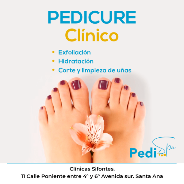 img/portfolio/categories/Posts/thumb/pedicure clínico.png